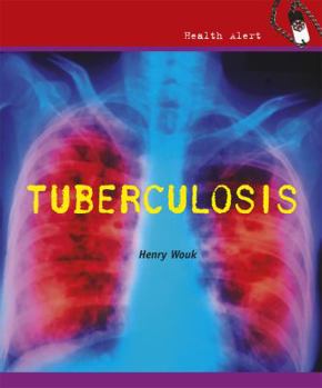 Tuberculosis - Book  of the Health Alert