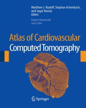 Hardcover Atlas of Cardiovascular Computed Tomography Book