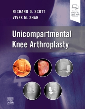 Hardcover Unicompartmental Knee Arthroplasty Book