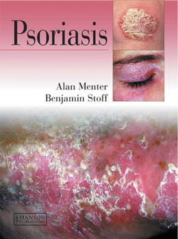 Hardcover Psoriasis Book