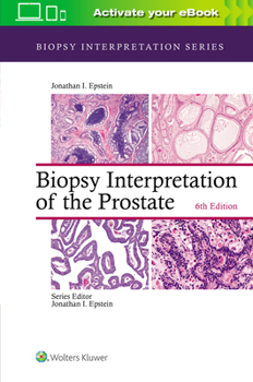 Hardcover Biopsy Interpretation of the Prostate Book