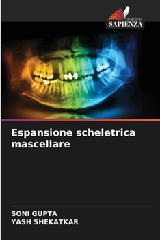 Espansione scheletrica mascellare (Italian Edition)