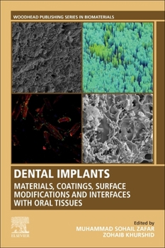 Paperback Dental Implants: Materials, Coatings, Surface Modifications and Interfaces with Oral Tissues Book