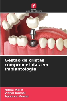 Paperback Gestão de cristas comprometidas em Implantologia [Portuguese] Book