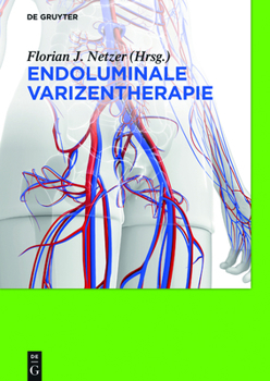 Hardcover Endoluminale Varizentherapie [German] Book