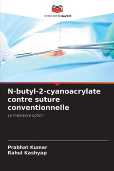 Paperback N-butyl-2-cyanoacrylate contre suture conventionnelle [French] Book