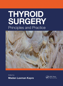 Paperback Thyroid Surgery: Principles and Practice Book