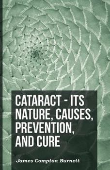 Paperback Cataract - Its Nature, Causes, Prevention, And Cure Book