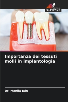 Importanza dei tessuti molli in implantologia (Italian Edition)