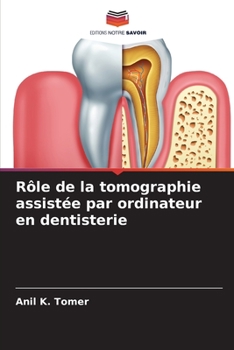 Paperback Rôle de la tomographie assistée par ordinateur en dentisterie [French] Book