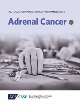 Paperback Protocol for Cancer Surgery Documentation: Adrenal Cancer (Protocols for Cancer Surgery Documentation) Book