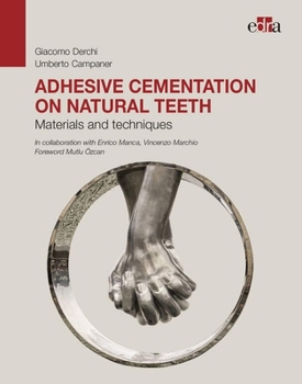Hardcover Adhesive Cementation on Natural Teeth. Materials and Techniques Book