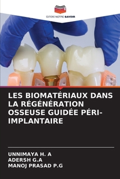 Les Biomatériaux Dans La Régénération Osseuse Guidée Péri-Implantaire (French Edition)
