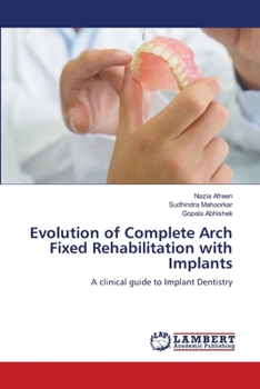 Paperback Evolution of Complete Arch Fixed Rehabilitation with Implants Book