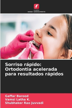 Sorriso rápido: Ortodontia acelerada para resultados rápidos (Portuguese Edition)