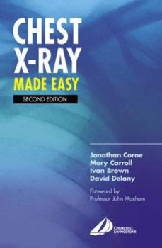 Paperback Chest X-Ray Made Easy Book
