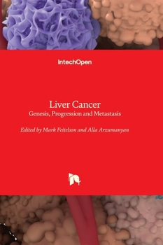 Hardcover Liver Cancer - Genesis, Progression and Metastasis Book
