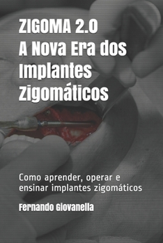 Paperback ZIGOMA 2.0 - A Nova Era dos Implantes Zigom?ticos: Como aprender, operar e ensinar implantes zigom?ticos [Portuguese] Book