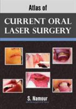 Paperback Atlas of Current Oral Laser Surgery Book