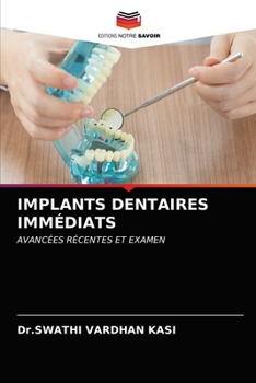 Paperback Implants Dentaires Immédiats [French] Book
