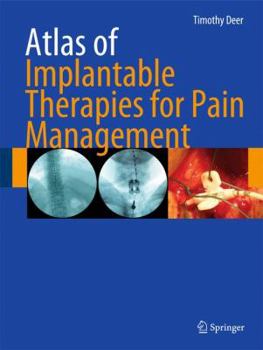 Hardcover Atlas of Implantable Therapies for Pain Management Book
