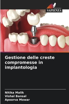 Paperback Gestione delle creste compromesse in implantologia [Italian] Book