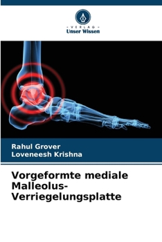 Paperback Vorgeformte mediale Malleolus-Verriegelungsplatte [German] Book