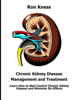 Paperback Chronic Kidney Disease Management and Treatment: Learn How to Best Control Chronic Kidney Disease and Minimize Its Effects Book