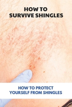 Paperback How To Survive Shingles: How To Protect Yourself From Shingles: How To Speed Up Shingles Recovery Book