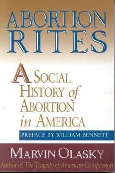 Paperback Abortion Rites: A Social History of Abortion in America Book