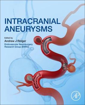 Paperback Intracranial Aneurysms Book