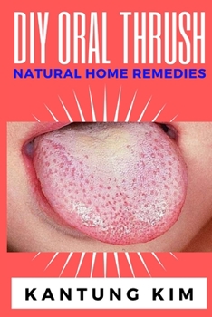 Paperback DIY Oral Thrush Natural Home Remedies: The Effective Step By Step Guide To Permanently End Oral Thrush Book