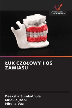 Paperback Luk Czolowy I OS Zawiasu (Polish Edition) [Polish] Book