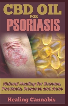 Paperback CBD Oil for Psoriasis: Natural Healing for Eczema, Psoriasis, Rosacea and Acne Book