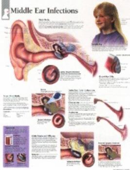 Paperback Middle Ear Infection Chart: Wall Chart Book