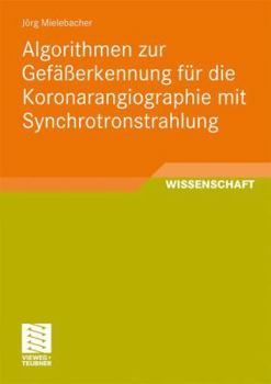 Paperback Algorithmen Zur Gefäßerkennung Für Die Koronarangiographie Mit Synchrotronstrahlung [German] Book