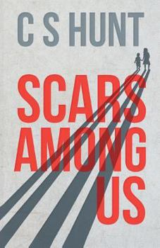 Paperback Scars Among Us Book