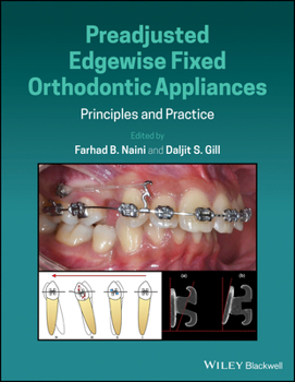 Hardcover Preadjusted Edgewise Fixed Orthodontic Appliances: Principles and Practice Book