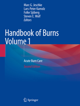 Paperback Handbook of Burns Volume 1: Acute Burn Care Book