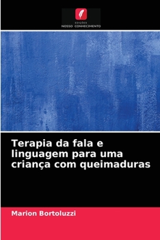 Paperback Terapia da fala e linguagem para uma criança com queimaduras [Portuguese] Book