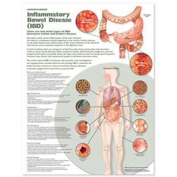 Wall Chart Understanding Inflammatory Bowel Disease (Ibd) Anatomical Chart Book