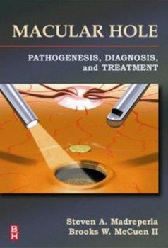 Paperback Macular Hole: Pathogenesis, Diagnosis, and Treatment Book