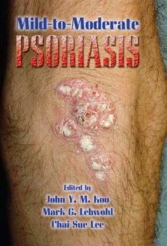 Hardcover Mild-to-Moderate Psoriasis Book