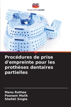 Procédures de prise d'empreinte pour les prothèses dentaires partielles (French Edition)