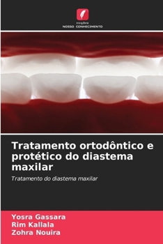 Paperback Tratamento ortodôntico e protético do diastema maxilar [Portuguese] Book