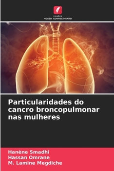 Paperback Particularidades do cancro broncopulmonar nas mulheres [Portuguese] Book