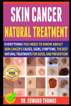 Paperback Skin Cancer Natural Treatment: Everything You Need To Know About Skin Cancer's Causes, Signs, Symptoms, The Best Natural Treatments For Good, And Pre Book