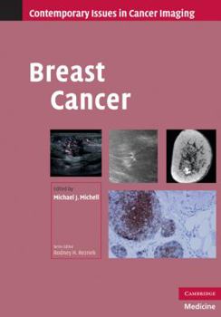 Hardcover Breast Cancer Book