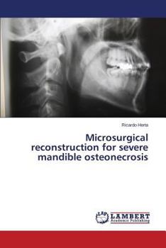 Paperback Microsurgical reconstruction for severe mandible osteonecrosis Book