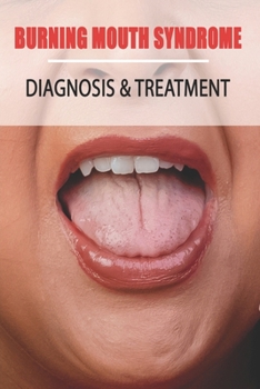 Paperback Burning Mouth Syndrome: Diagnosis & Treatment: Burning Mouth Syndrome Guide Book
